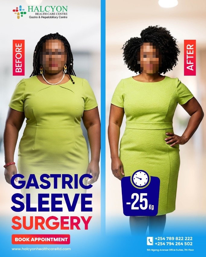 <strong style="color:#0c0b42;">25kg Down and Thriving:</strong> My Life After Gastric Sleeve Surgery