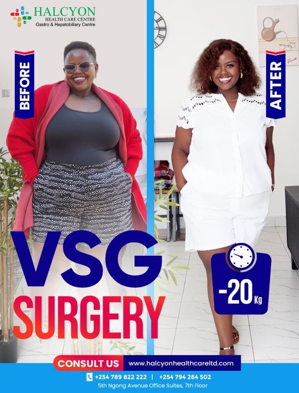 Loving My New Body | 20kgs Down! Real VSG Transformation Story